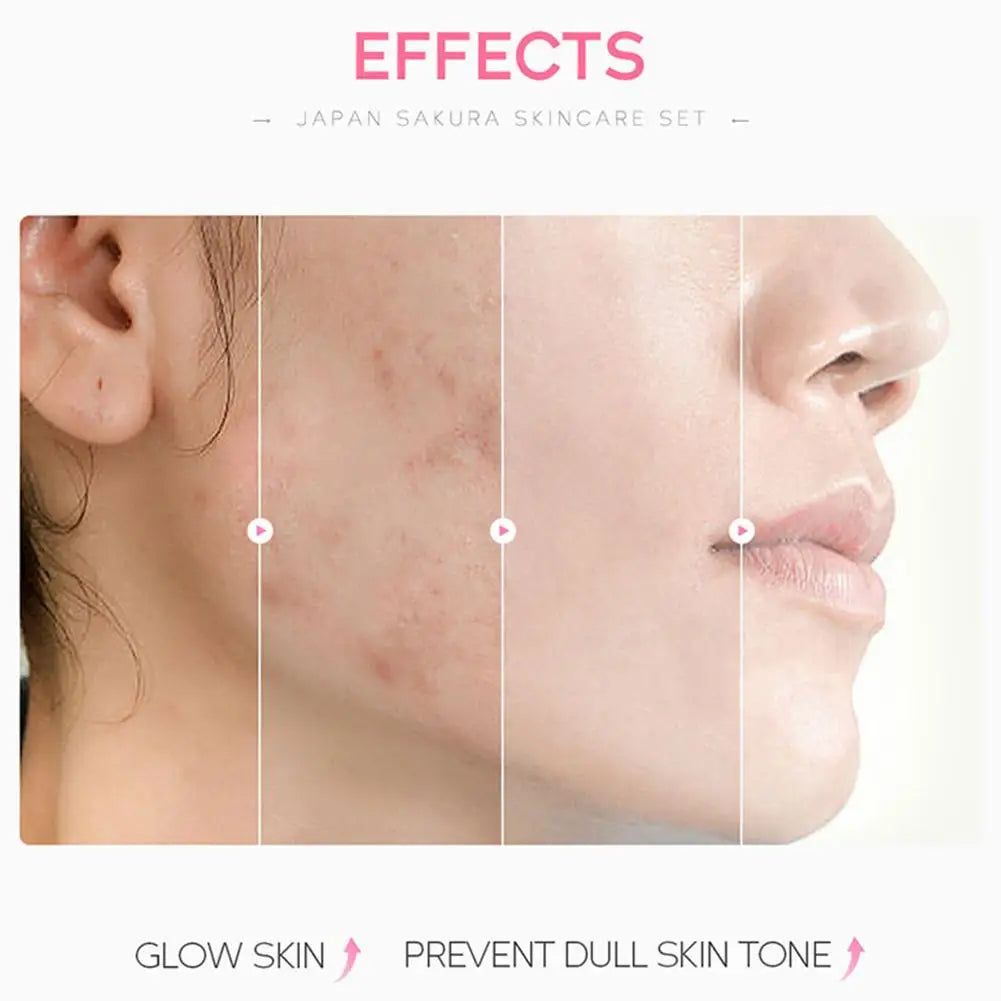 5/3pcs/Set Sakura Skin Care Sets